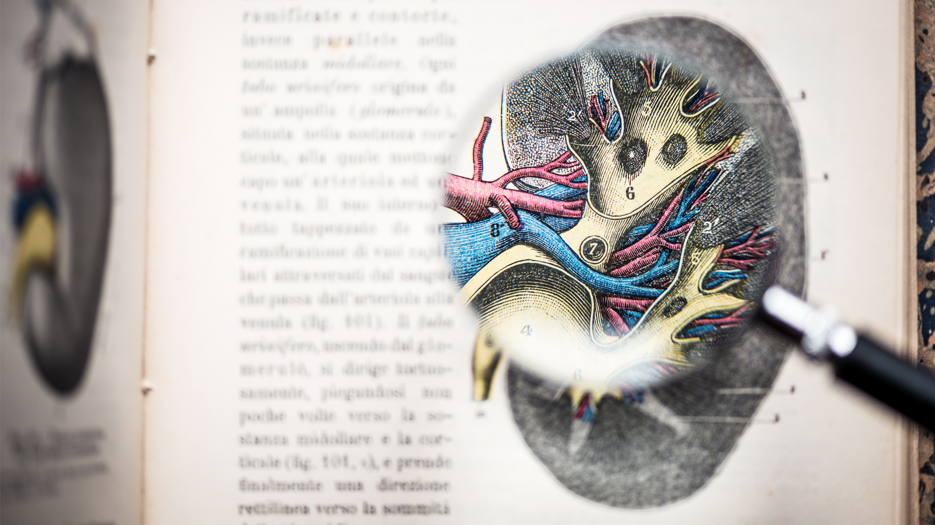 Mitral regurgitation treatment: more precise classification severity now likely