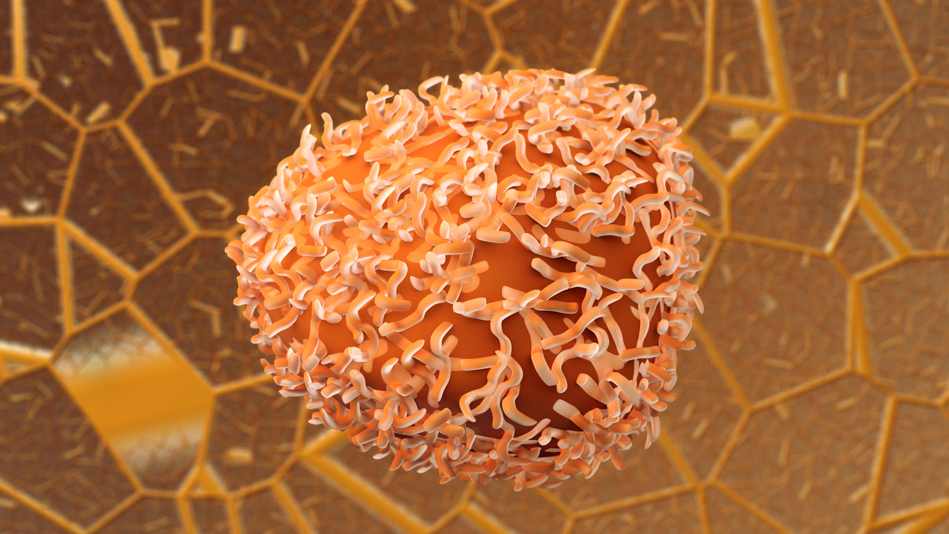 COLOSSUS: The first patient recruited in translational trial for metastatic colorectal cancer