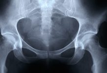 Health inequality: NHS-funded private sector hip operations worsening Health inequality: NHS-funded private sector hip operations worsening