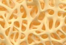 The use of bisphosphonate to prevent loss of bone mineral density in post-menopausal women The use of bisphosphonate to prevent loss of bone mineral density in post-menopausal women
