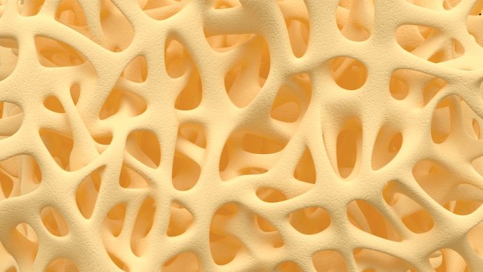 The use of bisphosphonate to prevent loss of bone mineral density in post-menopausal women