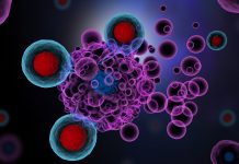 Using immunotherapy drugs to tackle treatment-resistant lymphoma