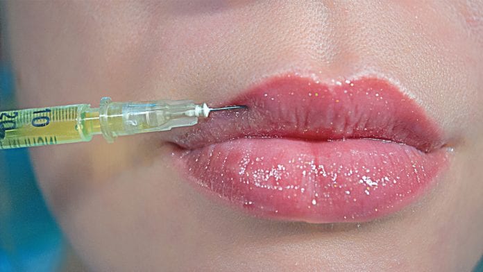 Lip augmentation: lip fillers are carving an attractive niche in the cosmetology industry