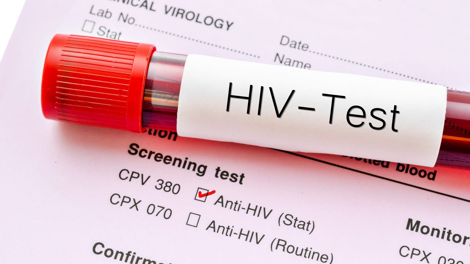 Annual HIV data shows a continued decline since 2000