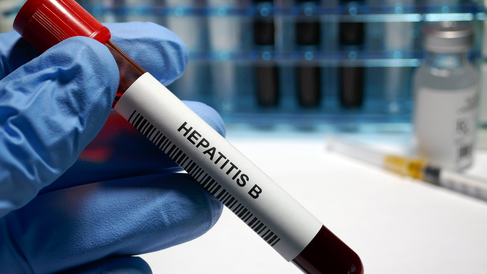Hepatitis B hope as new test offers improved diagnosis and management