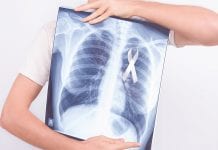 Lung Cancer Awareness: EU focus to reduce deaths and beat cancer