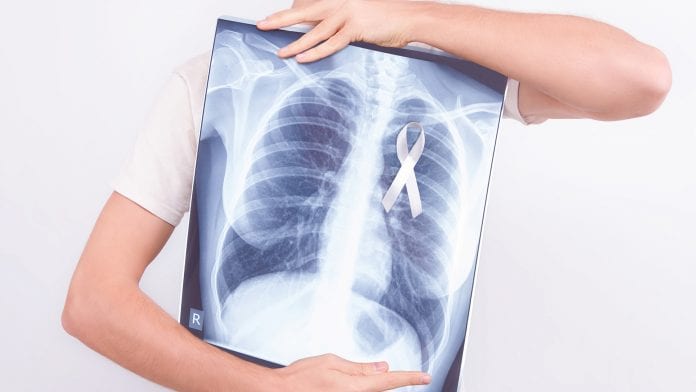 Lung Cancer Awareness: EU focus to reduce deaths and beat cancer