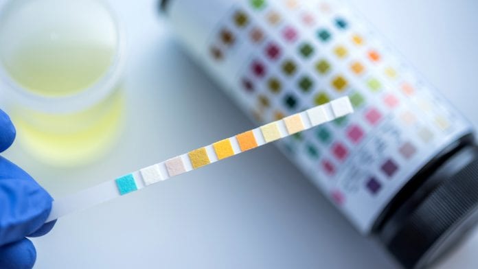 Is diagnosing cancer with a urine test a possibility?