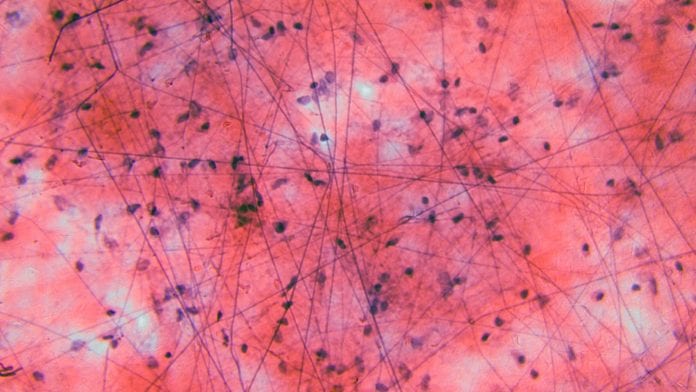 iStock-BeholdingEye DRS imaging technique can characterise healthy and non-healthy tissue