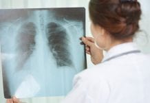 Artificial Intelligence can design new TB drug regimens