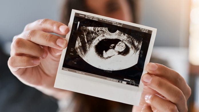 Placenta imaging method may aid diagnosis of pregnancy complications