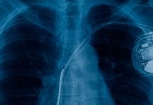 Developing next-generation biologic pacemakers with stem cells