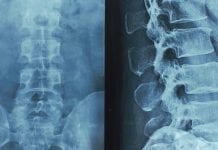 Nerve pain drug could help restore limb function after spinal cord injury