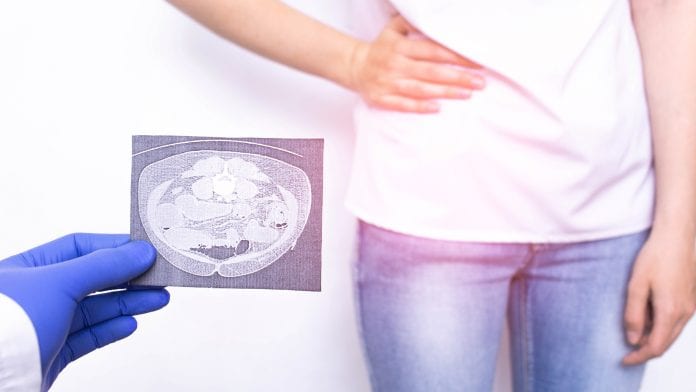 iStock-Henadzi Pechan Young UK women face unnecessary appendicitis surgery