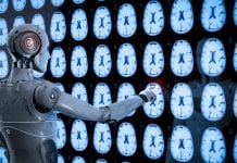 UK clinical network launches pioneering AI stroke project UK clinical network launches pioneering AI stroke project