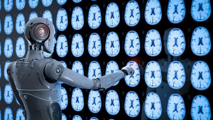 UK clinical network launches pioneering AI stroke project