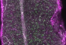 Bone marrow in 3D: new insights into stem cell microenvironment