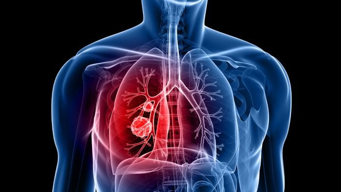 skeletal figure showing the lung