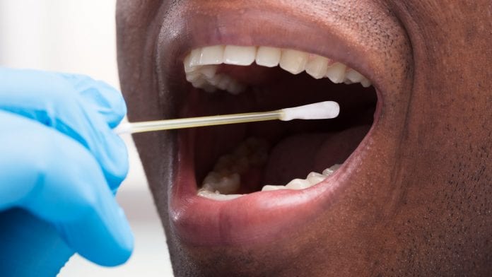 H12 UROTISS1 24009 pro image Mouth swab