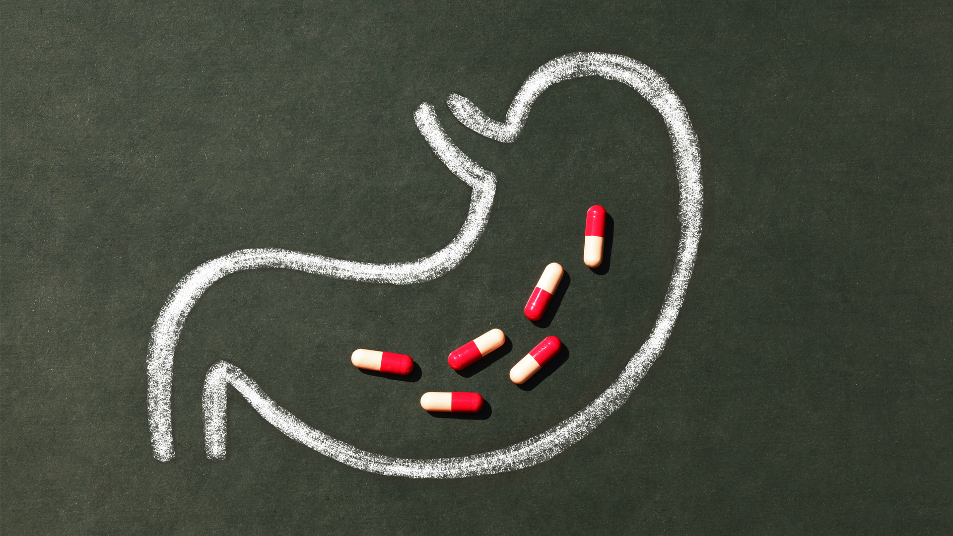 drawing of gut on chalk board with pills in the middle