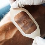 Smart, wearable insulin patch could revolutionise diabetes treatment