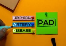 Peripheral artery disease: Is cocoa the answer? PAD. Peripheral Artery Disease acronym on sticky notes. Office desk background