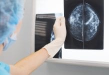 New breast cancer screening could revolutionise diagnosis