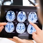 New neurodegenerative brain disorder discovered in children