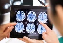 New neurodegenerative brain disorder discovered in children