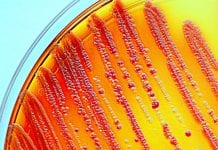 Have researchers discovered a compound that can kill superbugs? Enterobacteria grown on a selective agar plate. Part of the commensal microbion.