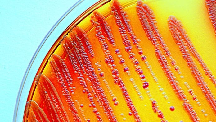 Enterobacteria grown on a selective agar plate. Part of the commensal microbion.