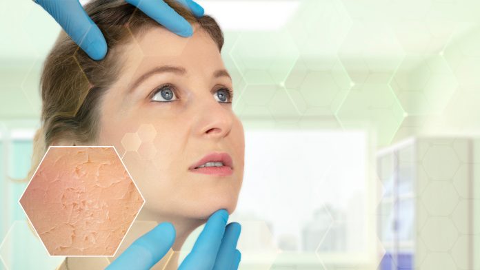 New AI tool helps medical professionals with diagnosing skin conditions