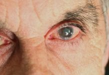 Discover how AI can help with early detection of glaucoma Discover how AI can help with early detection of glaucoma