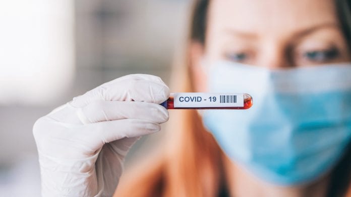 Experts provide insights on COVID-19 antibody tests
