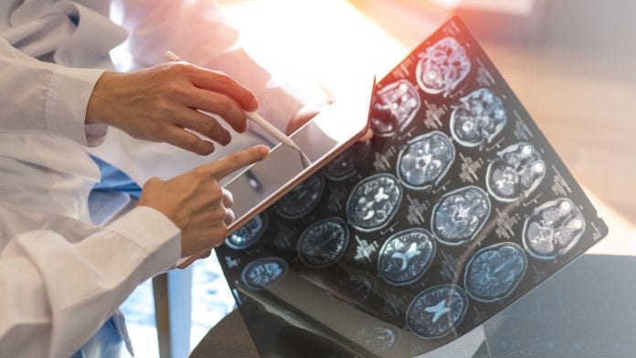 iStock-Pornpak Khunatorn Cognitive impairment treatment options for multiple sclerosis patients