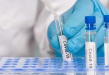 Timing of COVID-19 antibody test is critical say experts Timing of COVID-19 antibody test is critical say experts