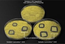 Infection prevention: you’ve done everything right – now protect the site You’ve done everything right – now protect the site