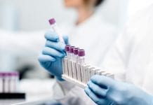 Potential treatment for rare degenerative disease discovered Potential treatment for rare degenerative disease discovered