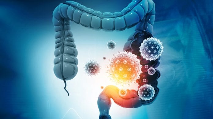 iStock-Rasi Bhadramani Chronic digestive diseases: gut microbiome and healthy nutrition