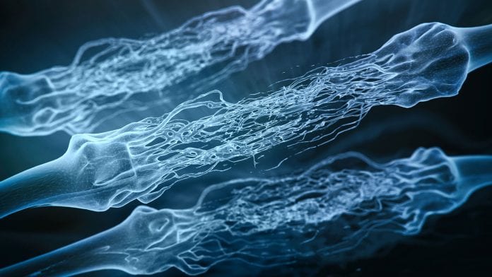 Groundbreaking research to restore myelin sheaths in multiple sclerosis