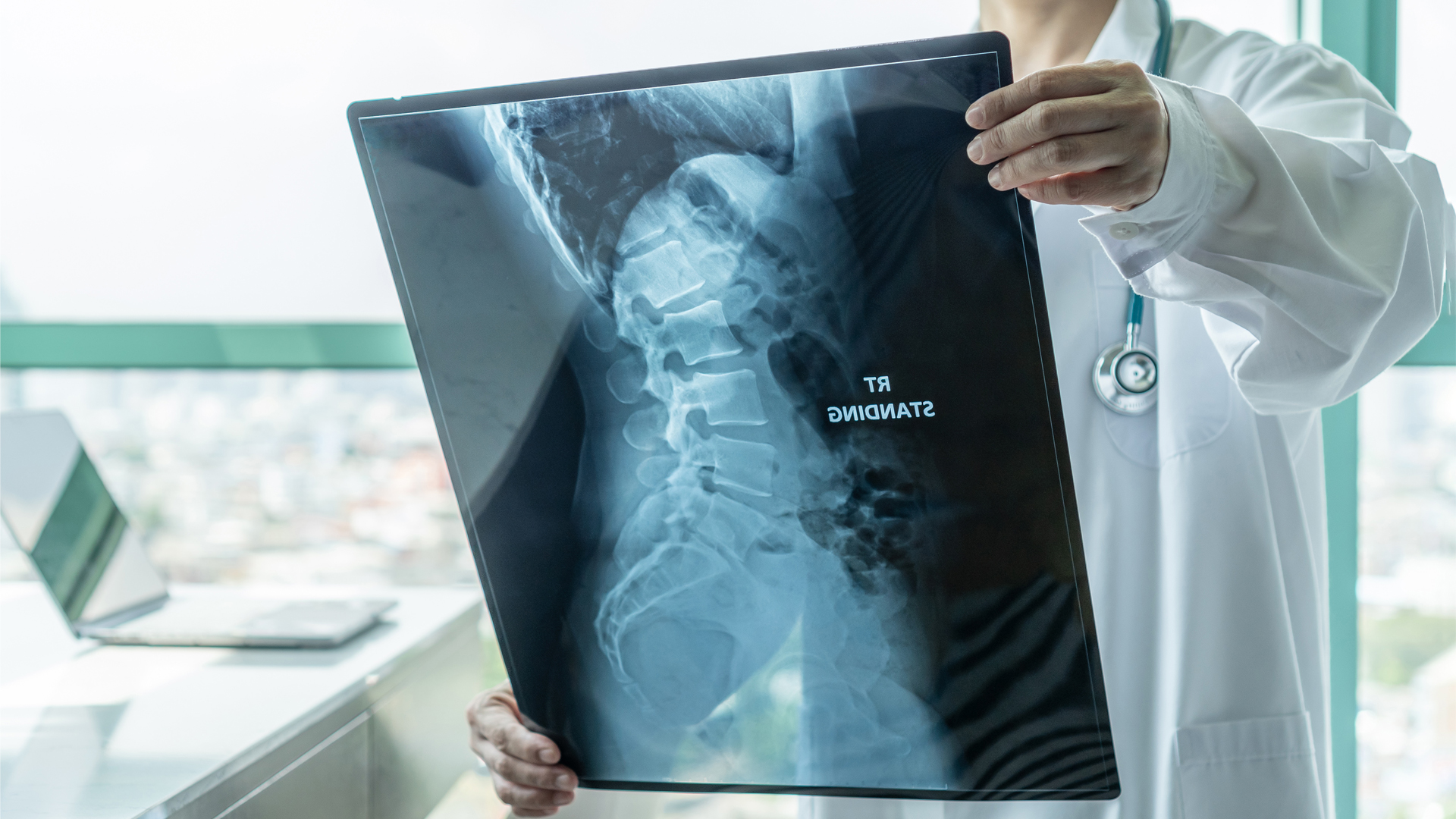 First at-home treatment for spinal muscular atrophy approved by FDA