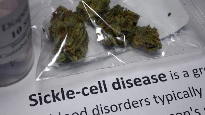 Clinical trial shows potential of cannabis to lessen sickle cell disease pain