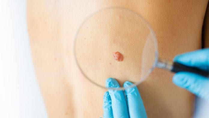 Safeguarding skin cancer services with the use of teledermatology