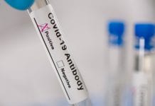 UK places first order for one million COVID-19 rapid antibody tests UK places first order for one million COVID-19 rapid antibody tests