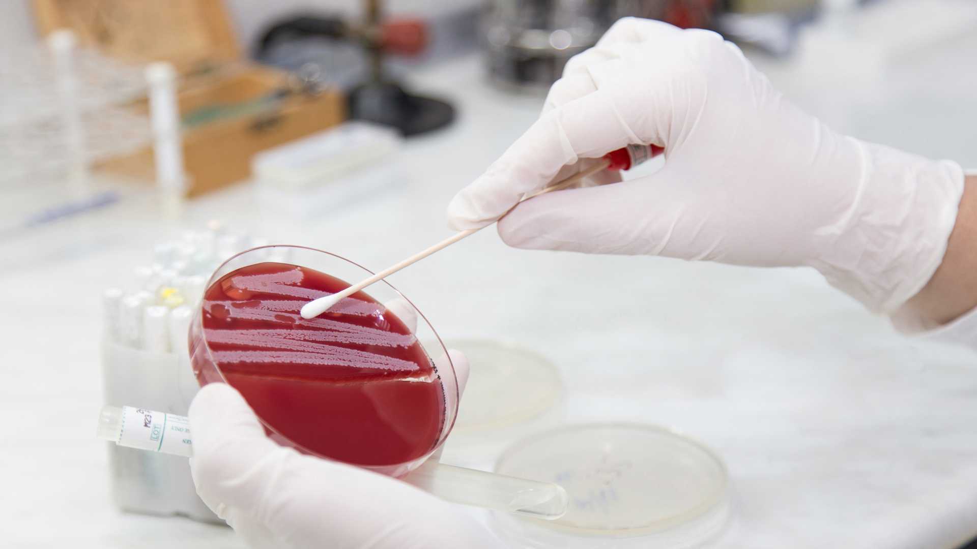 Hygiene compliance in preventing healthcare-associated infections