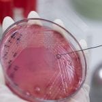 Global leaders advocate urgent action on antimicrobial resistance