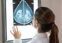 Mammography screening srill vital for reducing breast cancer deaths