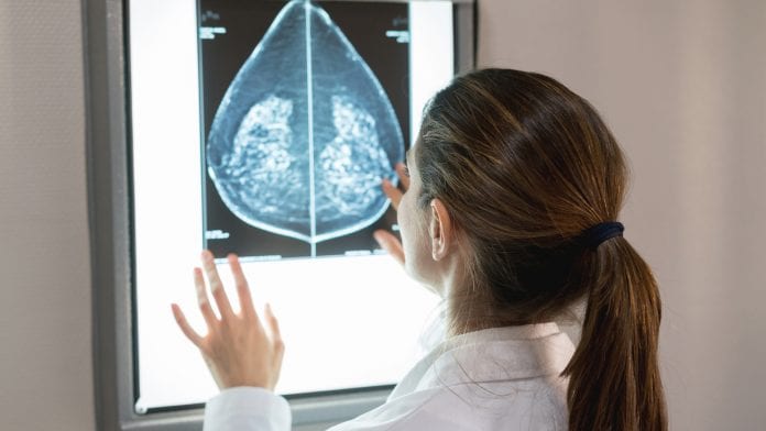 Mammography screening srill vital for reducing breast cancer deaths