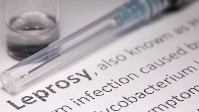iStock-Hailshadow Results from research programme could reduce global burden of leprosy