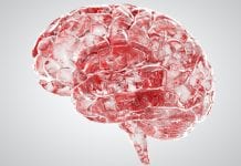 Subarachnoid haemorrhage fatality rate higher than previously thought subarachnoid haemorrhage